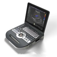 Portable ultrasound system FTL-UTS1600for gynecological and obstetric ultrasound imagingfor abdominal and pelvic ultrasound imagingcolor doppler