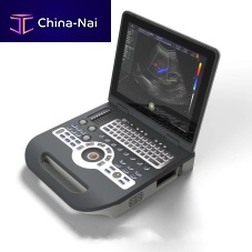 Portable ultrasound system FTL-UTS1600for gynecological and obstetric ultrasound imagingfor abdominal and pelvic ultrasound imagingcolor doppler