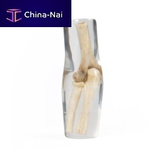 Radiography test phantom 7260elbow