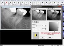 Dental imaging software Prof. Suniimage capturedata managementdiagnostic