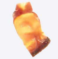 Cardiac tissue matrix CryoPatch® SGvascularallograft