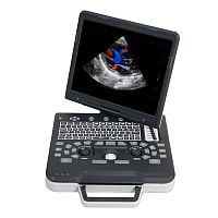 Portable ultrasound system Apogee 1000 Profor multipurpose ultrasound imagingfor cardiovascular ultrasound imagingB/W
