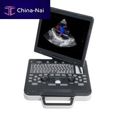 Portable ultrasound system Apogee 1000 Profor multipurpose ultrasound imagingfor cardiovascular ultrasound imagingB/W