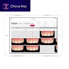 Dental iOS application ToothScout for dental prosthesis designfor smartphonesfor tablet PC
