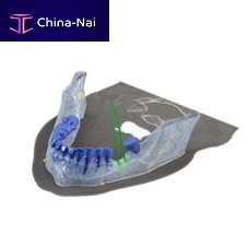 Dental implantology software Reconstruction 3Dfor dental implant simulation3D viewingmodeling