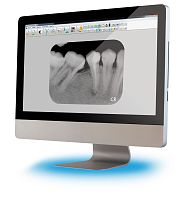 Dental imaging software treatmentviewerdental