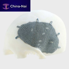 Custom-made cranial implant