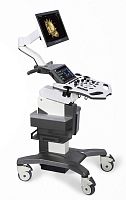 On-platform, compact ultrasound system VINNO X2for gynecological and obstetric ultrasound imagingfor urology ultrasound imaging3D/4D