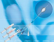 Stone extraction catheter GEB-xx seriesbiliaryballoondouble-lumen