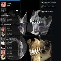 Dental iOS application mRomexisfor dental imagingclinicalvisualization
