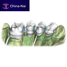 Dental software RestorationlaboratorytrainingCAD