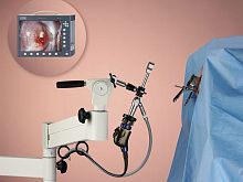 Endoscopic camera head VITOM®surgicalfor operating microscopesdigital