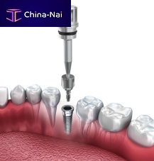Cylindrical healing abutment titaniumscrew