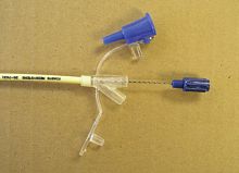 Radiopaque enteral feeding set J0350G PVC