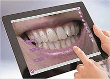 Laboratory software mobileAssistfor dental laboratoriesvisualizationtreatment