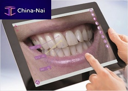 Laboratory software mobileAssistfor dental laboratoriesvisualizationtreatment