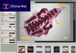 Medical software LAS EZfor digital microscopesvisualizationeducation