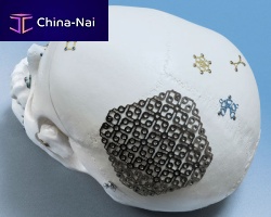 Non-absorbable cranial fixation system OPTIMUS