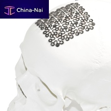 Cranial implant