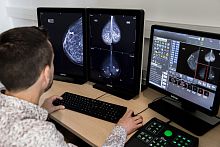Mammography software Breast-SlimViewdiagnosticfor breast cancer screeningmachine learning