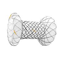 Pancreatic stent LAMSgastricmetal